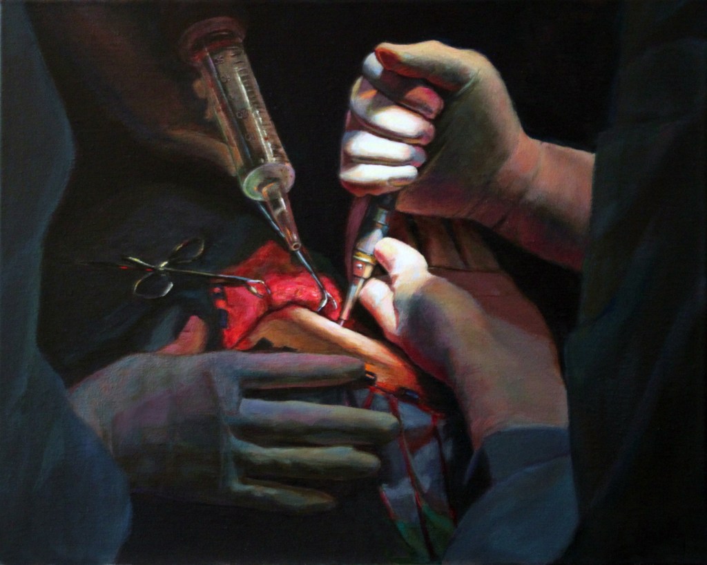 Craniotomy in G&nbsp;Sharp